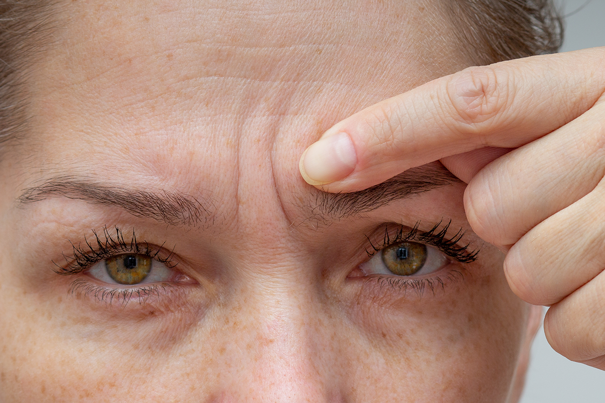 Woman pointing at wrinkles between eyebrows by finger